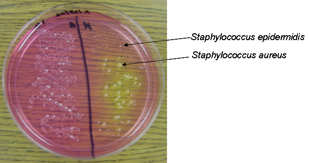 ppt-normal-and-transient-flora-host-parasite-relationships